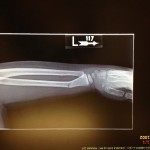 xray