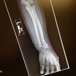 xray
